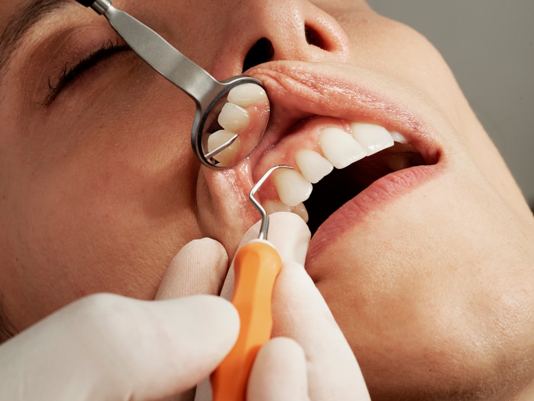 Why a Full Dental Checkup Could Save Your Smile