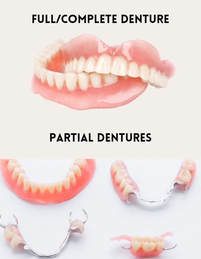 dentures are an affordable tooth replacement solution